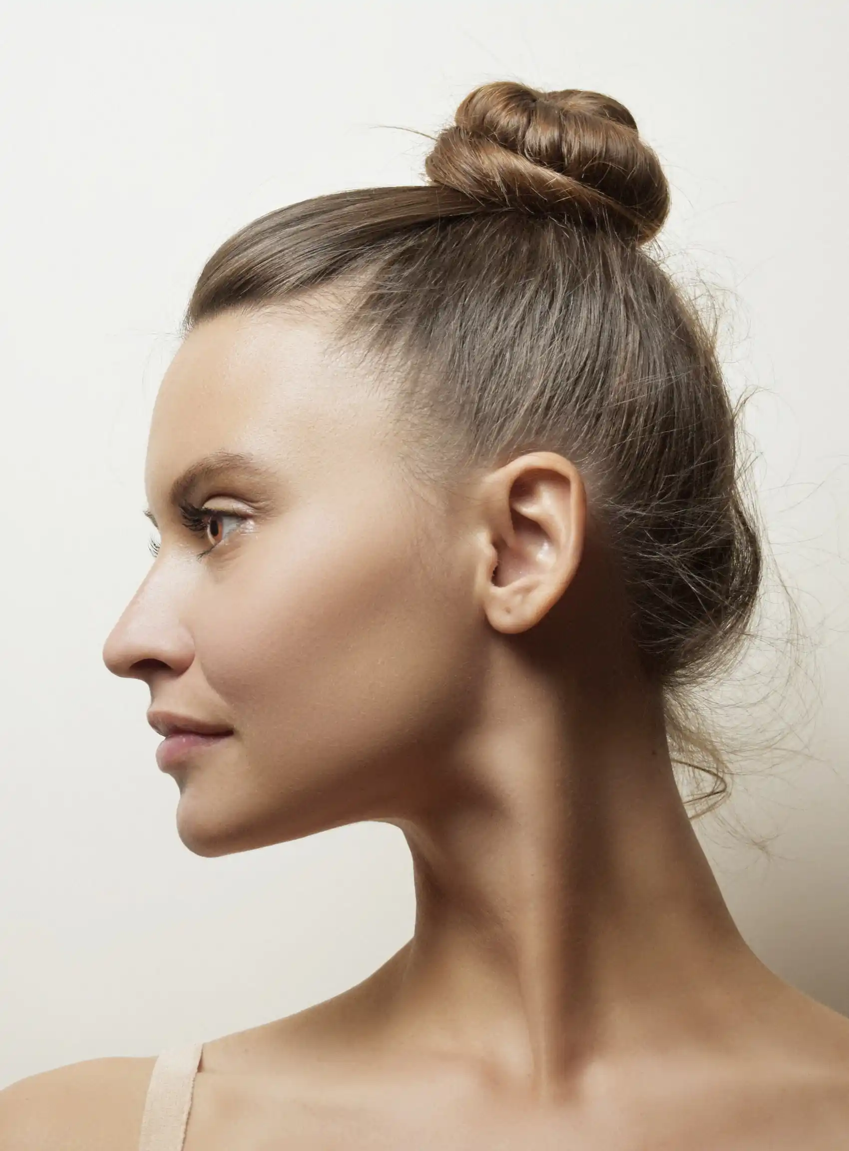 Alopecia en Mujeres ¿Como tratarla?